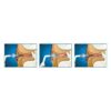 otoclear3