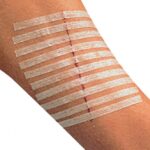 steristrip